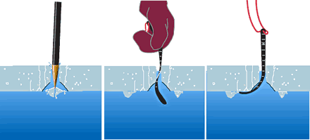 Ice Thickness Measurer